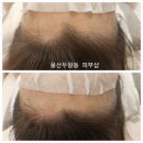 수정헤어라인 - 김해시 인제로169번길 10 | 수정헤어라인
