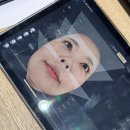 수의원 | 통증역치 최약체도 받을 수 있는 솔린의원 울쎄라피프라임 솔직 후기, 가격도 합리적!