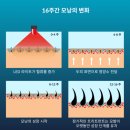 커런트바디 LED 탈모예방 두피관리기 한 달 사용 후기