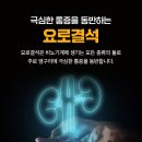 요로결석 후기 증상과 원인 전조증상 체크