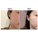 코리아엔제이 | 대구 피부관리 제이라인코리아 예신 관리 솔직후기