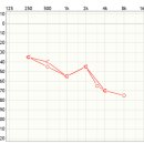 야탑보청기 난청센터 이미지