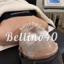 씨유 순천매력점 | 순천 피부관리 잘하는 곳! 벨리노40 에스테틱 물방울리프팅 리얼 후기