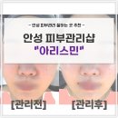 안성 피부관리샵 아리스민 베이직관리 후기