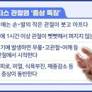 감별 필요한 ‘류마티스 관절염’ ABC 이미지