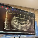 탑메디의원 | 🦷🪥 [동탄 치과 추천] 동탄 탑치과 / 금 골드 인레이 실제 후기 / 과잉진료X 양심진료O / 온누리 지역...