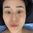 분당삼평-D-7 | [분당/판교] 얼굴 비대칭 관리 잘하는 곳 스킨타임스파 판교점 페이스 수분관리 후기