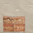 드림치주과치과의원 | 부산 하단동 드림치주과치과 방문 후기