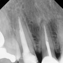 수원탑플란트치과의원 이미지