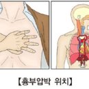 생명을 살리는 심폐소생술(CPR) 이미지