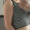 정드림노인병원 - 1769 | 팔지방흡입 1년차 유지 복부지흡 6개월차 후기 공유해드림