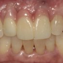 뉴치과기공소 이미지