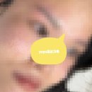 차스킨 - 수원시 권선구 하탑로30번길 27 | [피부관리] 내돈내산 | 포텐자+서브시전+쥬베룩 스킨 후기 1회차 :: 여드름 패인 흉터 치료