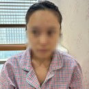프린스성형외과의원 | 여성 헤어라인 이식 고민하기까지(옥건헤어라인)