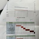 하니헬멧 두상교정 2개월차 후기