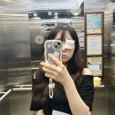 태신드림시티 | 김해 신세계안과의원: 다래끼 수술 후기