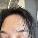 [건선새치커버] 동남지구미용실 아이디헤어 엘로이 천연염색 후기