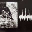 남원장문외과의원 | 변비 아기 태아 젤리곰 시기 형태 확인 임산부 비타민D 수치 확인 채혈 서울아이나여성의원 졸업 준비