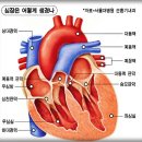 심장질환의 종류 이미지