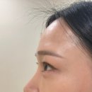 에이치래쉬 이미지