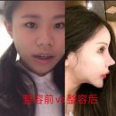 성형수술 100번 받은 중국소녀~ 이미지