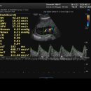 11545-11-31-30 | [임신#11] (후기) 임신 30 &amp;31주차 기록