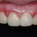 라이브치과기공소 이미지