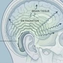 다음보청기 이미지