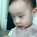 고구려대학교  우리병원 앞 | 아기 폐렴 기관지염 구로 우리아이들병원 2인실 입원 기간 후기