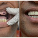 미르치과기공소 이미지