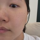 한스헤어 - 계양구 | 광주피부관리 한스라벨르 수완장덕점 스킨부스터 관리 후기