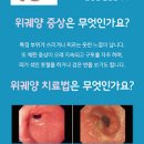 배꼽 주변 통증 원인 및 : 위 아래 왼쪽 오른쪽 이미지