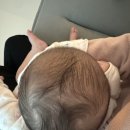 연세로이재활의학과의원 | 9월 8일~14일(D+50~56) / 사경 의심 해프닝(연세로이재활의학과 주말 오픈런 진료), 50일의 세미기적...