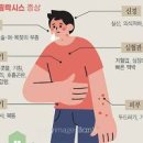 쇼크 증상, 종류 (저혈량성, 심인성, 아나필락시스 쇼크) 이미지