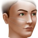 유엔아이소프트 | 벨로테로 앞광대 시술 후기 만족도를 가르는 기준