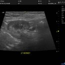 2/24 베리 뿌리동물병원 내원(혈액검사, X-ray, 복부 초음파 검사자료) 이미지