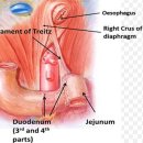 장출혈[Gastrointestinal bleeding] 이미지
