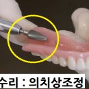 청구치과기공소 이미지