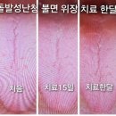 민강한의원 네이버블로그