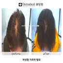 엠지에프두피탈모전문센터 분당점
