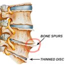 척추가 중심 이미지