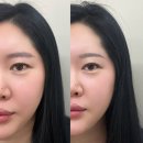 아르나뷰티(Arna beauty) | 인천 루원시티 반영구화장 | 아르나뷰티