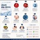 부싯돌 가동