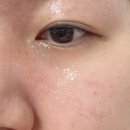 진주에스테틱 시청근처 한스라벨르 추천