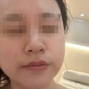 본식 전 남천동 신부관리 팔뚝 조짐 당한 후기, 고아진에스테틱
