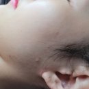 이미란 | 마포피부관리 &#39;고혹미&#39; 프리미엄 슈퍼젝션 케어로 물광피부 탄생