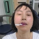 금곡로36번길 37 | 나의 치아 치료 후기 _ 종각역 연세 마이덴 치과 신경치료 후 인상체득(크라운 본뜸)하고 왔어요