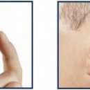 에바다보청기 이미지