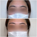 도봉-쌍문-도봉-1373 | 쌍문왁싱 꼼비왁싱에서 눈썹왁싱으로 깔끔해진 후기