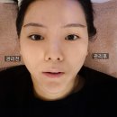 AWOON 아운 | [반포동에스테틱/아운 반포서래점]서래마을 얼굴 피부관리 효과최고 기계관리 제대로 해주셨던 곳